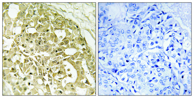 Anti-Catenin-β antibody produced in rabbit affinity isolated antibody
