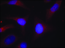 Anti-phospho-NFKBIA (pSer32/pSer36) antibody produced in rabbit affinity isolated antibody