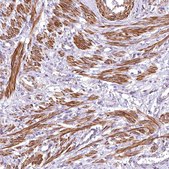 Anti-DPP3 antibody produced in rabbit Prestige Antibodies® Powered by Atlas Antibodies, affinity isolated antibody, buffered aqueous glycerol solution