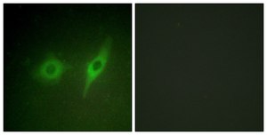 Anti-Collagen IV α2 antibody produced in rabbit affinity isolated antibody
