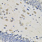 Anti-ITGA2 antibody produced in rabbit