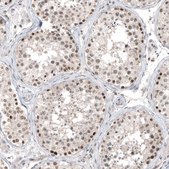 Monoclonal Anti-HDAC5 antibody produced in mouse Prestige Antibodies® Powered by Atlas Antibodies, clone CL8121, purified immunoglobulin, buffered aqueous glycerol solution