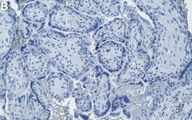 Anti-Laminin-5 Antibody, clone 1D3 ZooMAb® Rabbit Monoclonal recombinant, expressed in HEK 293 cells