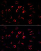 Anti-SGK1 antibody produced in rabbit