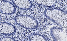 Anti-Histone H3-Lys9me3 Antibody, clone 4J8 ZooMAb® Rabbit Monoclonal recombinant, expressed in HEK 293 cells