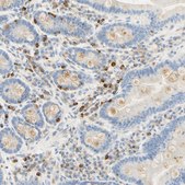 抗-CD63 兔抗 affinity isolated antibody, Prestige Antibodies® Powered by Atlas Antibodies, buffered aqueous glycerol solution