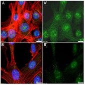 Anti-Myc Tag Antibody Upstate®, from rabbit