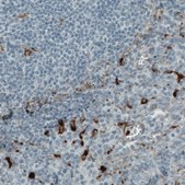 Monoclonal Anti-MMP9 antibody produced in mouse Prestige Antibodies® Powered by Atlas Antibodies, clone CL0539, purified immunoglobulin, buffered aqueous glycerol solution