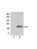 Anti-trimethyl (Lys9)-phospho (Ser10)-Histone H3 Antibody, rabbit monoclonal Upstate®, from rabbit