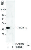 Rabbit anti-CKII beta Antibody, Affinity Purified Powered by Bethyl Laboratories, Inc.