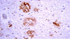 Anti-Beta-Amyloid 1-42 Antibody Chemicon®, from rabbit
