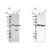 Anti-G6PD antibody produced in rabbit Prestige Antibodies® Powered by Atlas Antibodies, affinity isolated antibody, buffered aqueous glycerol solution