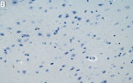 Anti-Tau Antibody, clone T49 ZooMAb® Mouse Monoclonal recombinant, expressed in HEK 293 cells