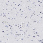 Anti-ZAP70 antibody produced in rabbit Prestige Antibodies® Powered by Atlas Antibodies, affinity isolated antibody, buffered aqueous glycerol solution
