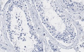 Anti-EZH2 Antibody, clone 6I10 ZooMAb® Rabbit Monoclonal recombinant, expressed in HEK 293 cells