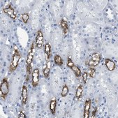 Anti-SLC12A1 antibody produced in rabbit Prestige Antibodies® Powered by Atlas Antibodies, affinity isolated antibody, buffered aqueous glycerol solution