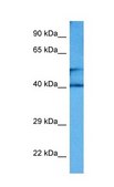 Anti-CKM (ab2) antibody produced in rabbit affinity isolated antibody