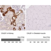 Anti-CALB1 antibody produced in rabbit Prestige Antibodies® Powered by Atlas Antibodies, affinity isolated antibody, buffered aqueous glycerol solution