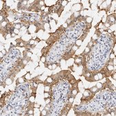 Anti-SLC9A3R1 antibody produced in rabbit Prestige Antibodies® Powered by Atlas Antibodies, affinity isolated antibody, buffered aqueous glycerol solution