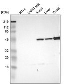 Anti-TYMP antibody produced in rabbit Prestige Antibodies® Powered by Atlas Antibodies, affinity isolated antibody