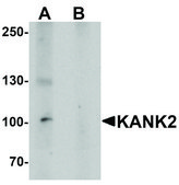 Anti-KANK2 antibody produced in rabbit affinity isolated antibody, buffered aqueous solution