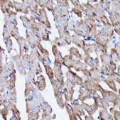 Anti-Prohibitin antibody produced in rabbit