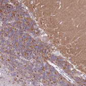Anti-KCNC1 antibody produced in rabbit Prestige Antibodies® Powered by Atlas Antibodies, affinity isolated antibody, buffered aqueous glycerol solution