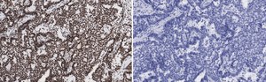 Anti-p-ATM (Ser1981) Antibody, clone 1E19, ZooMAb® Rabbit Monoclonal recombinant, expressed in HEK 293 cells