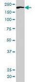Monoclonal Anti-ROCK1 antibody produced in mouse clone 2E2, purified immunoglobulin, buffered aqueous solution