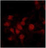 抗磷酸化Brd4（Ser492/Ser494） from rabbit, purified by affinity chromatography