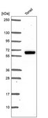 Anti-Esr2 Antibody Produced In Rabbit Prestige Antibodies® Powered by Atlas Antibodies, affinity isolated antibody, buffered aqueous glycerol solution