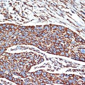 Anti-NDUFB8 antibody produced in rabbit