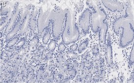 Anti-MYO1C Antibody, clone 4B19, ZooMAb® Rabbit Monoclonal recombinant, expressed in HEK 293 cells