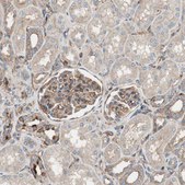 Anti-IL1RL1 antibody produced in rabbit Prestige Antibodies® Powered by Atlas Antibodies, affinity isolated antibody, buffered aqueous glycerol solution