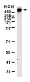 Anti-RYR1 Antibody, clone 1K4 ZooMAb® Rabbit Monoclonal recombinant, expressed in HEK 293 cells