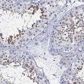 Anti-CETN1 antibody produced in rabbit Prestige Antibodies® Powered by Atlas Antibodies, affinity isolated antibody, buffered aqueous glycerol solution