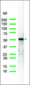 Anti-Vimentin antibody, Rabbit monoclonal clone SP20, recombinant, expressed in proprietary host, tissue culture supernatant