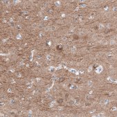 Anti-RYR2 antibody produced in rabbit Prestige Antibodies® Powered by Atlas Antibodies, affinity isolated antibody, buffered aqueous glycerol solution