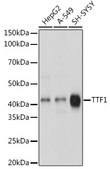 Anti-NKX2-1 Antibody, clone 3O2N3, Rabbit Monoclonal