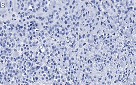 Anti-phospho-GSK-3α Ser21 Antibody, clone 1E22 ZooMAb® Rabbit Monoclonal recombinant, expressed in HEK 293 cells