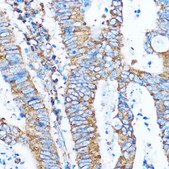 Anti-PIK3CA antibody produced in rabbit