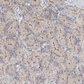 Anti-ADRB2 antibody produced in rabbit Prestige Antibodies® Powered by Atlas Antibodies, affinity isolated antibody, buffered aqueous glycerol solution