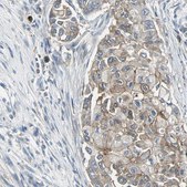 Anti-OCLN antibody produced in rabbit Prestige Antibodies® Powered by Atlas Antibodies, affinity isolated antibody, buffered aqueous glycerol solution