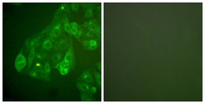 Anti-Connexin 43 antibody produced in rabbit affinity isolated antibody