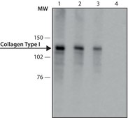 抗I型胶原蛋白抗体，小鼠单克隆 clone COL-1, purified from hybridoma cell culture