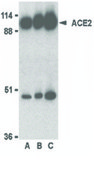 抗-ACE2 兔抗 affinity isolated antibody