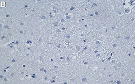 Anti-P2RY12 Antibody, clone 2C12 ZooMAb® Rabbit Monoclonal recombinant, expressed in HEK 293 cells