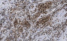 Anti-CTCF antibody, clone 1B18, ZooMAb® Rabbit monoclonal recombinant, expressed in HEK 293 cells