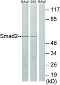 Anti-SMAD2 antibody produced in rabbit affinity isolated antibody