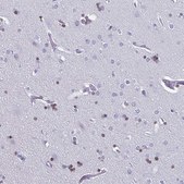 Anti-OLIG2 antibody produced in rabbit Prestige Antibodies® Powered by Atlas Antibodies, affinity isolated antibody, buffered aqueous glycerol solution
